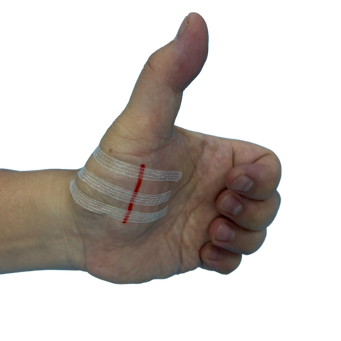 Wound Closure Adhesive Strips Wound Closure Adhesive Strips